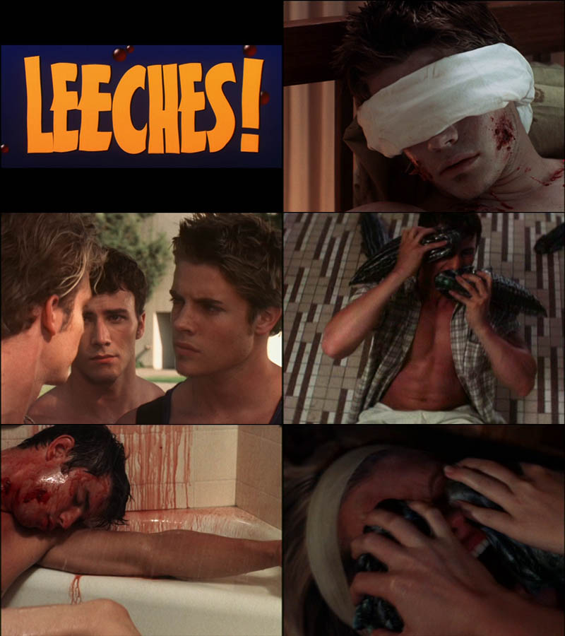 Leeches!